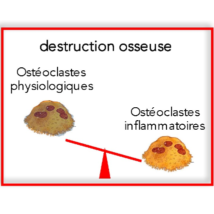 osteoclastes